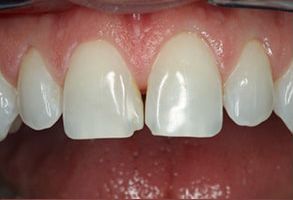 Dentasia Dental Services | Teeth Whitening, Night Guards and Cosmetic Dentistry